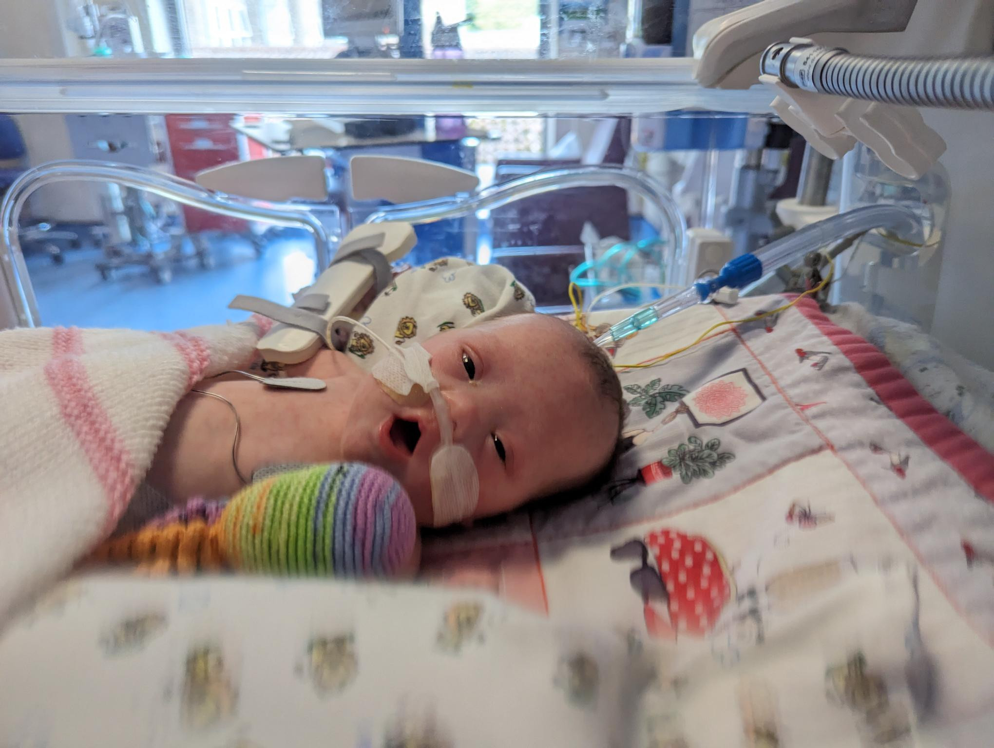 Baby Darcy in hospital - image of a baby with a tube in her nose in a NICU crib