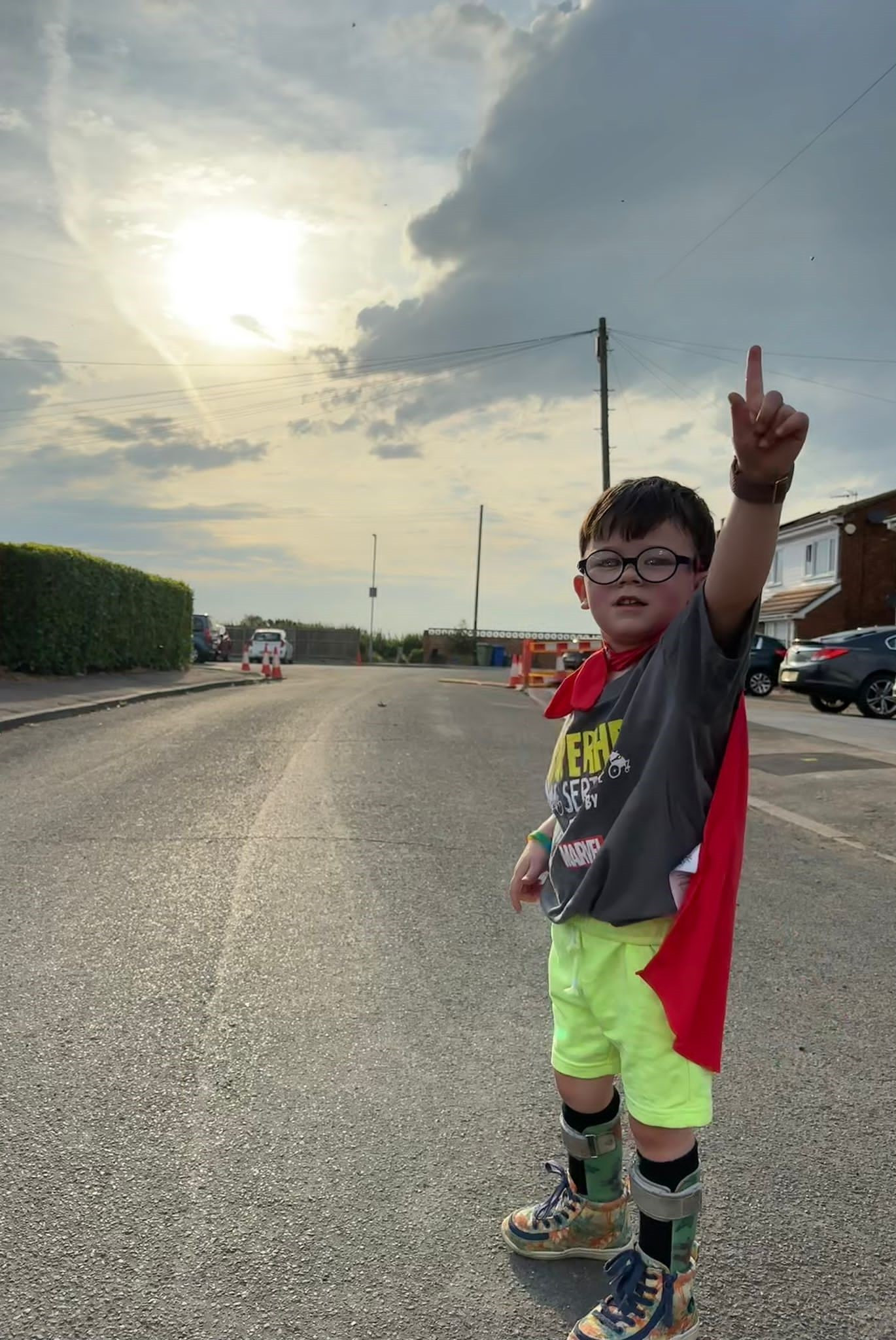 Little Vincent Simester at the start of his superhero challenge. Image shows a child pictured outside wearing a cape and with splints on his legs. He is doing a superman pose.